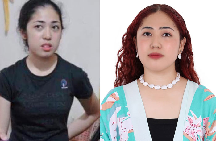 69 Side-By-Side Photos That Show That People Changed For The Better Over Time 69 Side-By-Side Photos That Show That People Changed For The Better Over Time