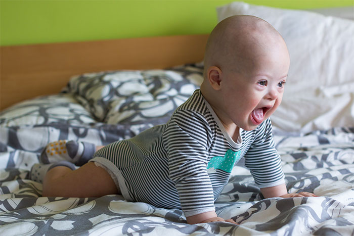 Mom’s Confession About Having A Baby With Down Syndrome Gets A Heartwarming Update A Year Later Mom’s Confession About Having A Baby With Down Syndrome Gets A Heartwarming Update A Year Later