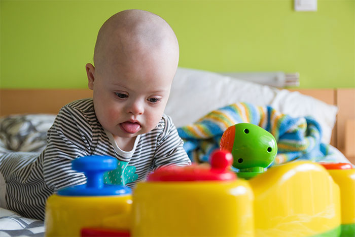 Mom’s Confession About Having A Baby With Down Syndrome Gets A Heartwarming Update A Year Later Mom’s Confession About Having A Baby With Down Syndrome Gets A Heartwarming Update A Year Later