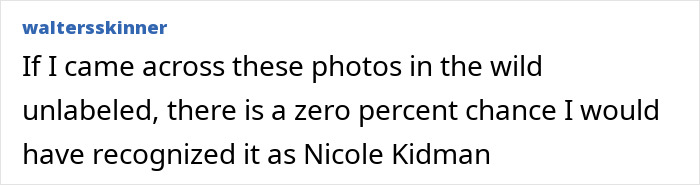 “That Is NOT Nicole Kidman”: Plastic Surgeon Weighs In On Why Actress Looks So Different In New Photos “That Is NOT Nicole Kidman”: Plastic Surgeon Weighs In On Why Actress Looks So Different In New Photos