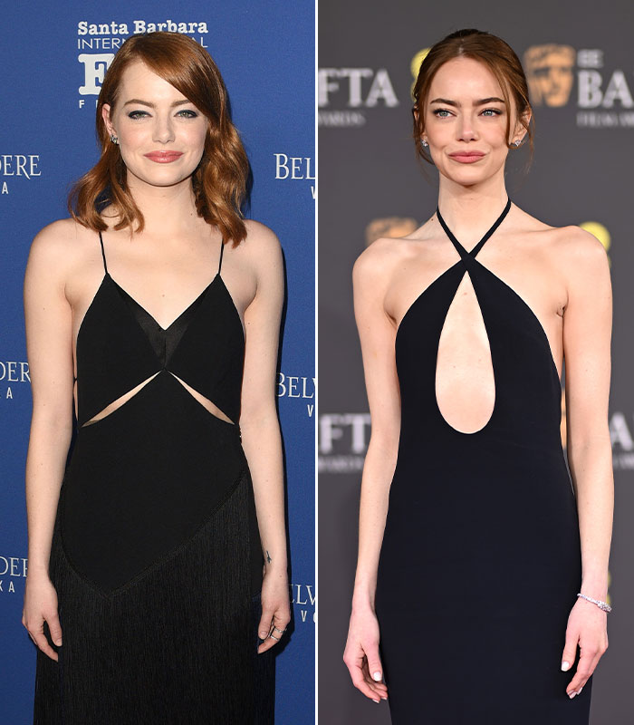 10 Celebrity Women Whose Fans Are Highly Concerned About Their Weight, As Doctor Reveals Risks
