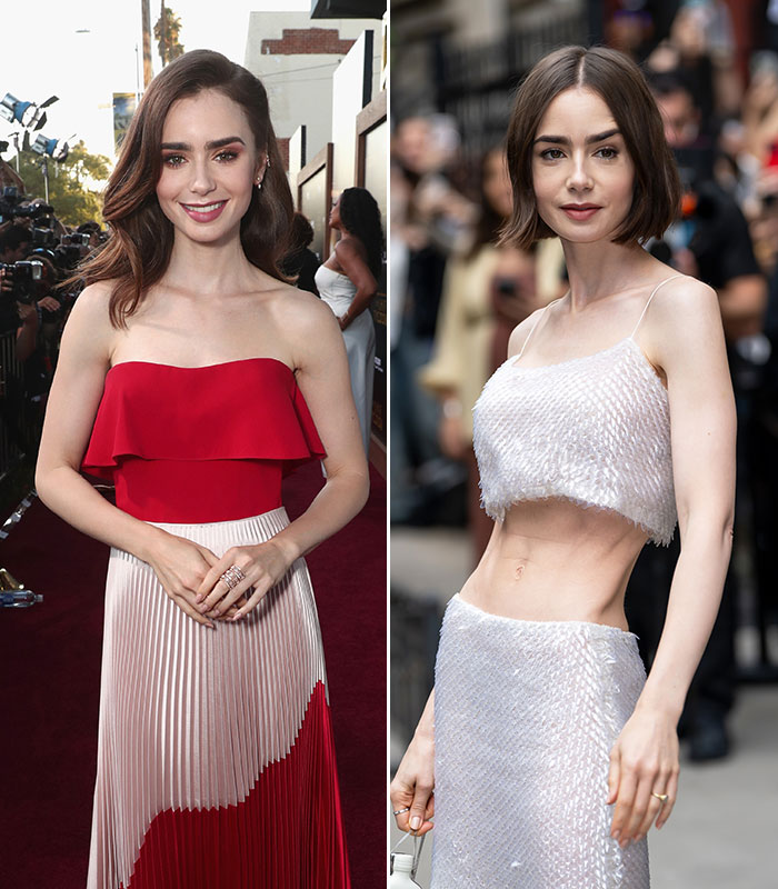 10 Celebrity Women Whose Fans Are Highly Concerned About Their Weight, As Doctor Reveals Risks