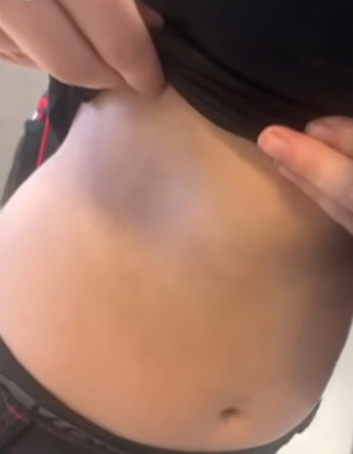 Karma Strikes As 13-Year-Old Faces Charges After Dodgeball Incident Leaves Ex-Girlfriend Hospitalized Karma Strikes As 13-Year-Old Faces Charges After Dodgeball Incident Leaves Ex-Girlfriend Hospitalized