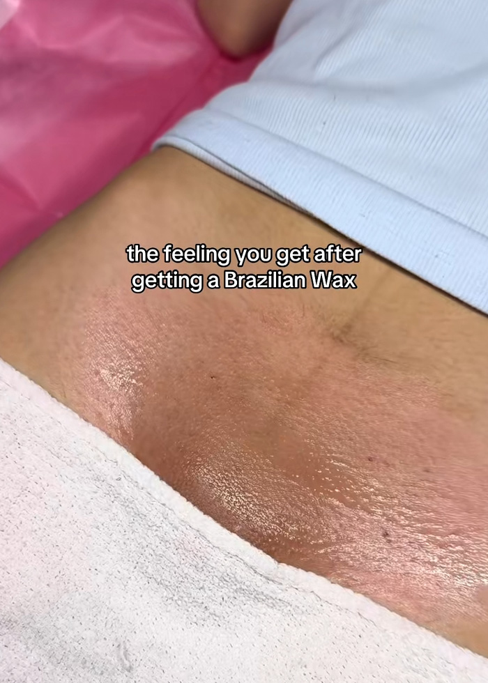 Brazilian Wax Client Goes Viral After Revealing The Embarrassing Side Effect Salons Fail To Mention And The Chilling Name For It Brazilian Wax Client Goes Viral After Revealing The Embarrassing Side Effect Salons Fail To Mention And The Chilling Name For It