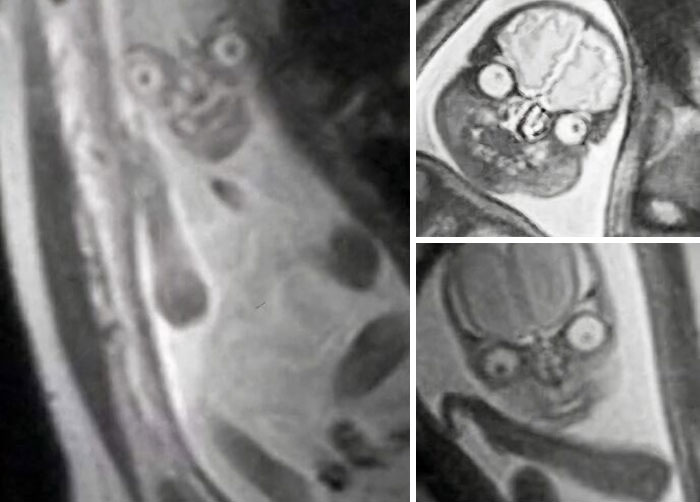 96 Wild Pictures That Make You Appreciate How Weird And Wonderful The World Is