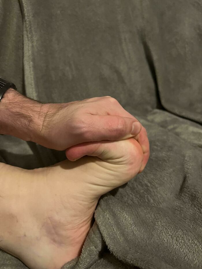 96 Wild Pictures That Make You Appreciate How Weird And Wonderful The World Is
