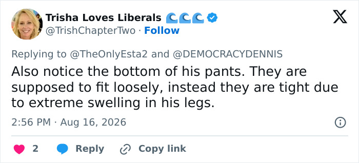 Trump&rsquo;s &ldquo;Mystery Bulge&rdquo; Leads To Frenzied Reactions As Many Speculate What Could Be In His Pants