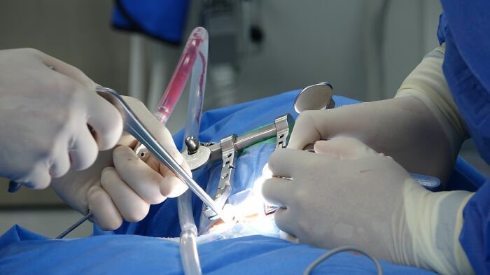 150 Patients Share The Medical Procedures That Hurt Far More Than Doctors Had Led Them To Expect