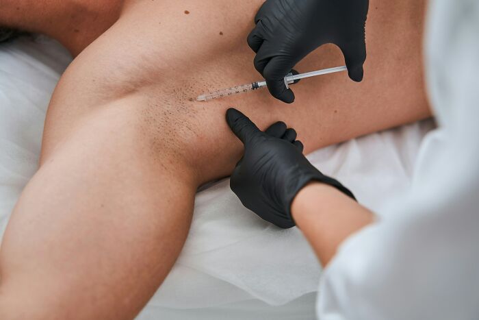 150 Patients Share The Medical Procedures That Hurt Far More Than Doctors Had Led Them To Expect
