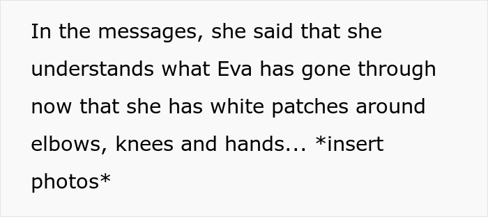 Guy’s Mom Makes His GF’s Vitiligo Her Favorite Insult, Stops Laughing When She Develops It Herself Guy’s Mom Makes His GF’s Vitiligo Her Favorite Insult, Stops Laughing When She Develops It Herself