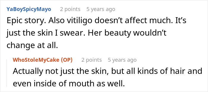 Guy’s Mom Makes His GF’s Vitiligo Her Favorite Insult, Stops Laughing When She Develops It Herself Guy’s Mom Makes His GF’s Vitiligo Her Favorite Insult, Stops Laughing When She Develops It Herself
