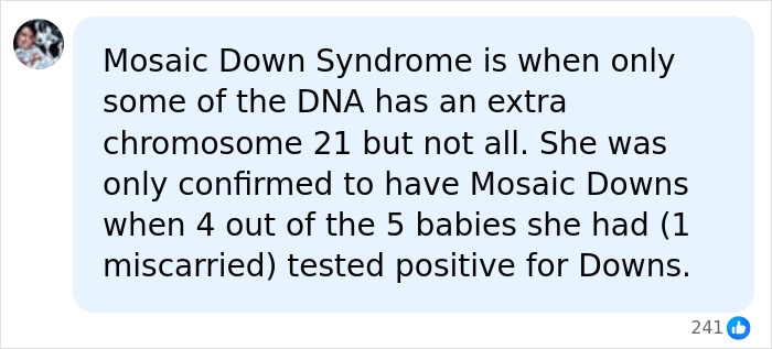 23YO Mother Of Four Gets Unexpected Down Syndrome Diagnosis, Says Her Kids Led To Answers 23YO Mother Of Four Gets Unexpected Down Syndrome Diagnosis, Says Her Kids Led To Answers