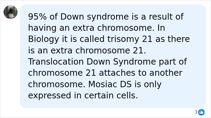 23YO Mother Of Four Gets Unexpected Down Syndrome Diagnosis, Says Her Kids Led To Answers 23YO Mother Of Four Gets Unexpected Down Syndrome Diagnosis, Says Her Kids Led To Answers
