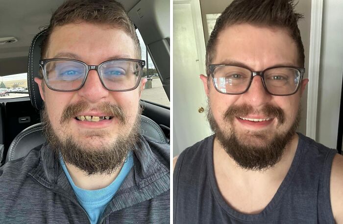 70 Times “Ugly Ducklings” Underwent Incredible Transformations And Stole The Show (New Pics) 70 Times “Ugly Ducklings” Underwent Incredible Transformations And Stole The Show (New Pics)