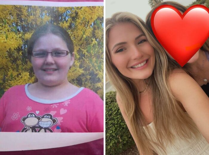 70 Times “Ugly Ducklings” Underwent Incredible Transformations And Stole The Show (New Pics) 70 Times “Ugly Ducklings” Underwent Incredible Transformations And Stole The Show (New Pics)