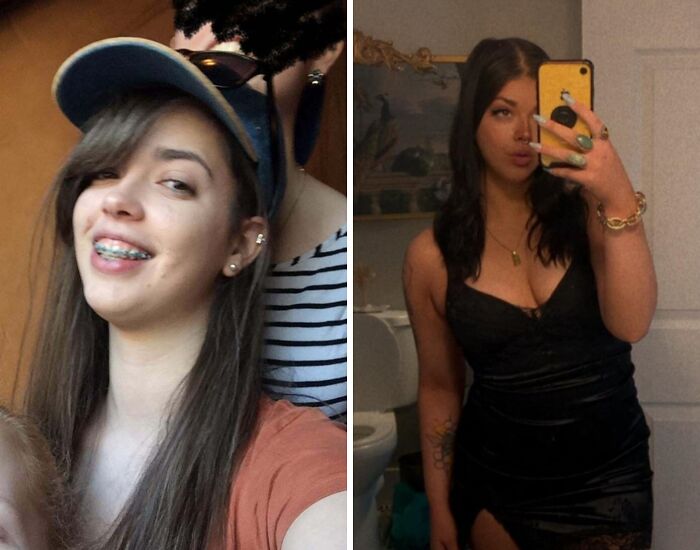 70 Times “Ugly Ducklings” Underwent Incredible Transformations And Stole The Show (New Pics) 70 Times “Ugly Ducklings” Underwent Incredible Transformations And Stole The Show (New Pics)