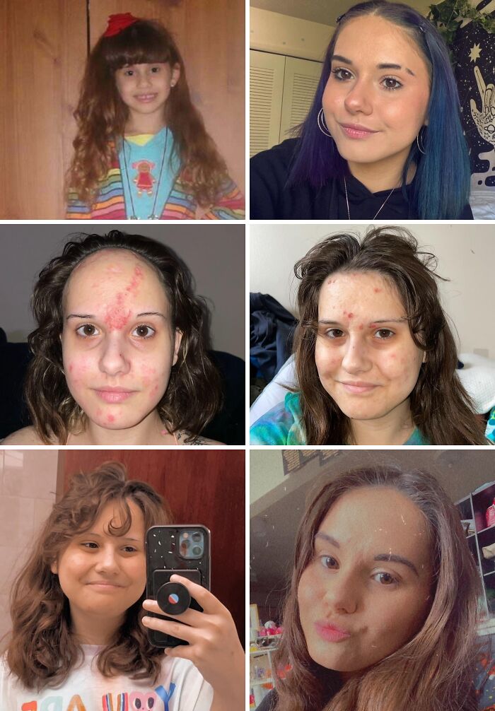 70 Times “Ugly Ducklings” Underwent Incredible Transformations And Stole The Show (New Pics) 70 Times “Ugly Ducklings” Underwent Incredible Transformations And Stole The Show (New Pics)