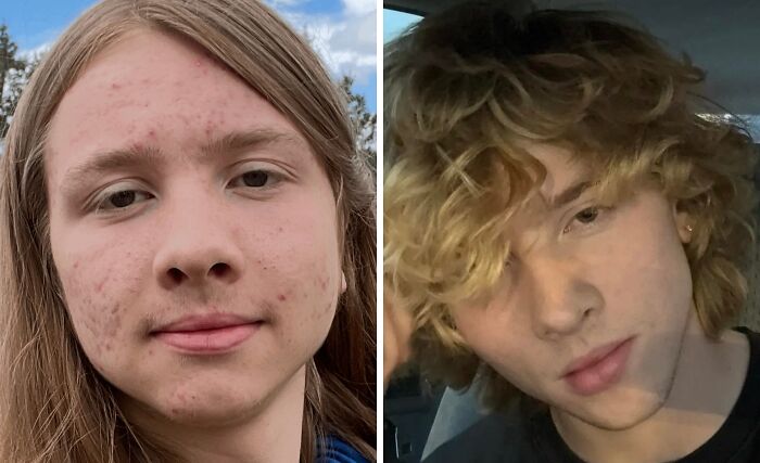 70 Times “Ugly Ducklings” Underwent Incredible Transformations And Stole The Show (New Pics) 70 Times “Ugly Ducklings” Underwent Incredible Transformations And Stole The Show (New Pics)