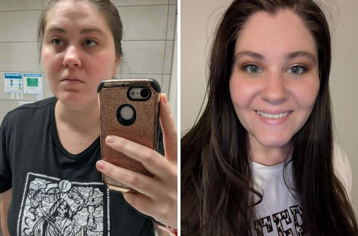 70 Times “Ugly Ducklings” Underwent Incredible Transformations And Stole The Show (New Pics) 70 Times “Ugly Ducklings” Underwent Incredible Transformations And Stole The Show (New Pics)
