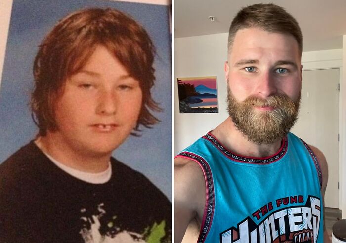70 Times “Ugly Ducklings” Underwent Incredible Transformations And Stole The Show (New Pics) 70 Times “Ugly Ducklings” Underwent Incredible Transformations And Stole The Show (New Pics)