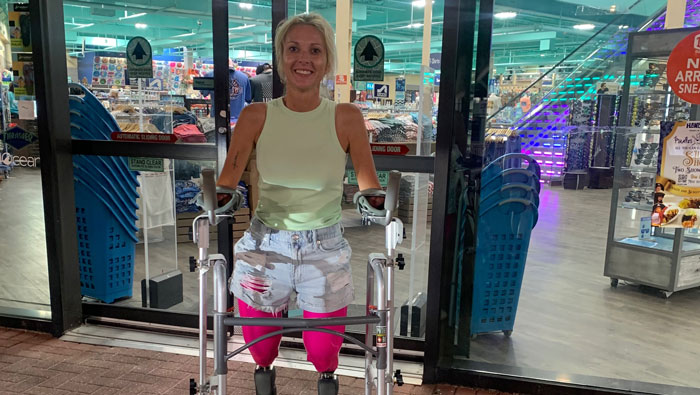 Woman Had Both Legs And Hands Amputated After Routine Surgery, And Her Reaction Moves People Woman Had Both Legs And Hands Amputated After Routine Surgery, And Her Reaction Moves People