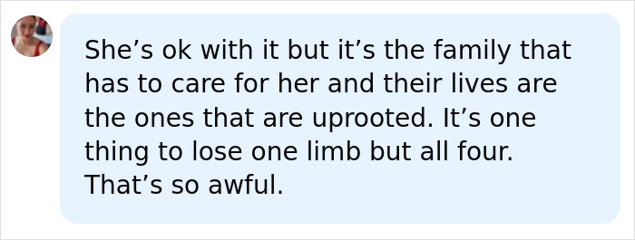 Woman Had Both Legs And Hands Amputated After Routine Surgery, And Her Reaction Moves People Woman Had Both Legs And Hands Amputated After Routine Surgery, And Her Reaction Moves People