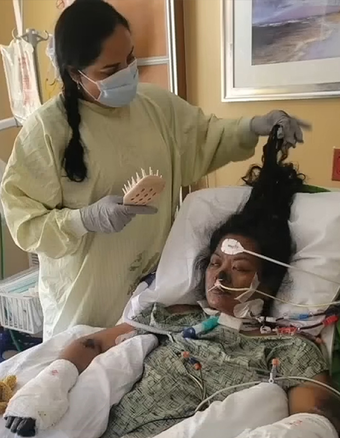 Strength Athlete, 41, Loses Arms And Legs After Routine Checkup Takes Horrifying Turn Strength Athlete, 41, Loses Arms And Legs After Routine Checkup Takes Horrifying Turn
