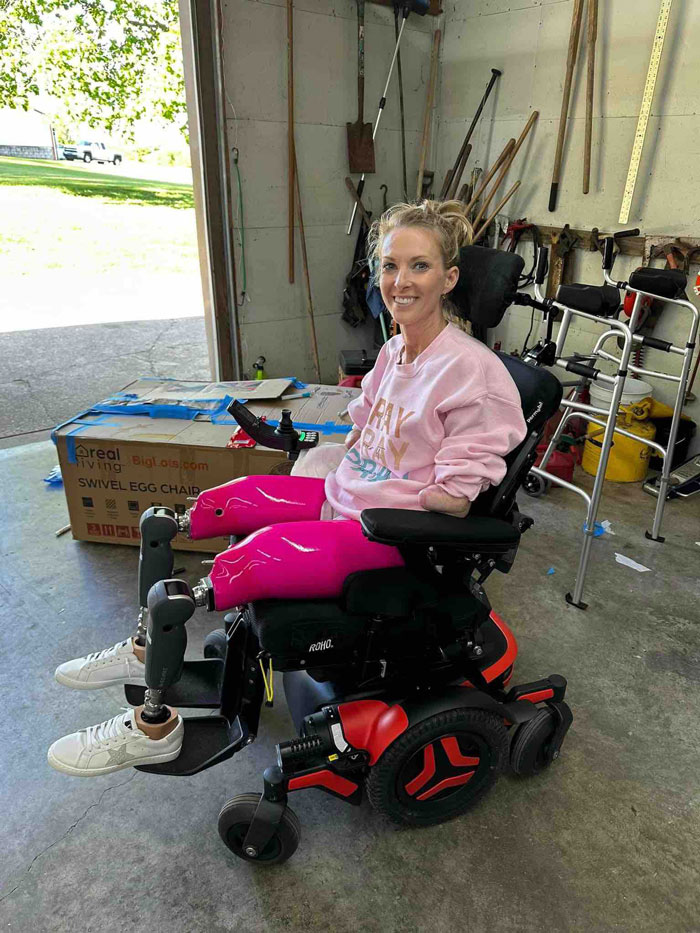 Strength Athlete, 41, Loses Arms And Legs After Routine Checkup Takes Horrifying Turn Strength Athlete, 41, Loses Arms And Legs After Routine Checkup Takes Horrifying Turn