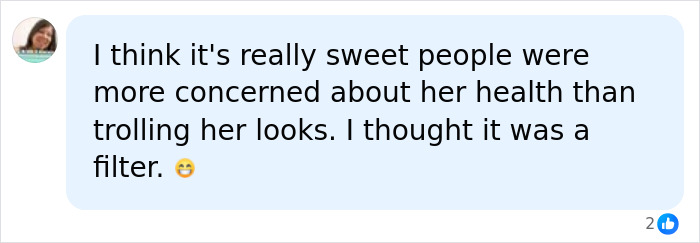 Woman Flooded With Messages Urging Her To Seek Help After Noticing Unique Detail Of Daughter’s Appearance Woman Flooded With Messages Urging Her To Seek Help After Noticing Unique Detail Of Daughter’s Appearance