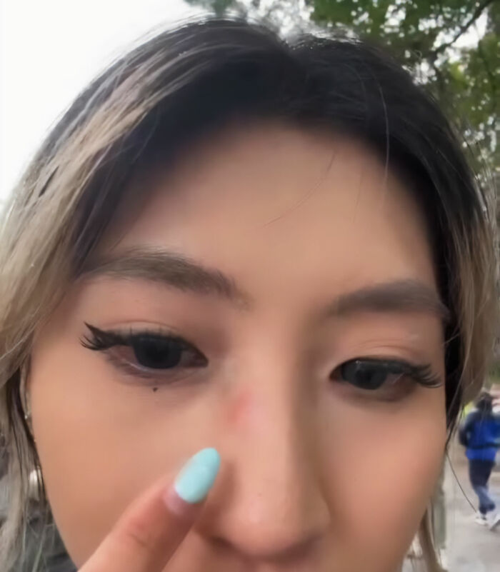 International Student Issues Urgent Plea After She’s Punched By Gang Of Kids Wearing Bathrobes In Scotland International Student Issues Urgent Plea After She’s Punched By Gang Of Kids Wearing Bathrobes In Scotland