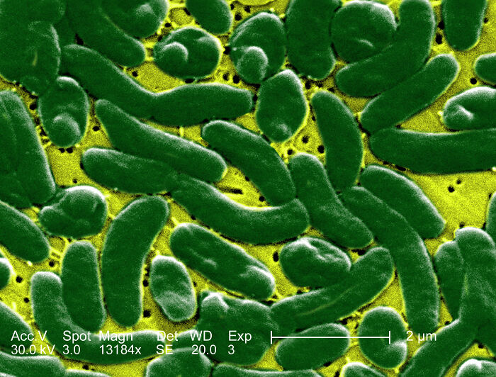 Woman Who Lost ‘A Lot Of My Leg’ To Flesh-Eating Bacteria Warns Women About Common Pre-Swim Habit Woman Who Lost ‘A Lot Of My Leg’ To Flesh-Eating Bacteria Warns Women About Common Pre-Swim Habit