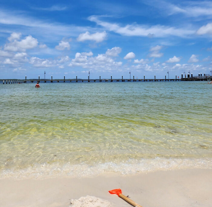 Woman Who Lost ‘A Lot Of My Leg’ To Flesh-Eating Bacteria Warns Women About Common Pre-Swim Habit Woman Who Lost ‘A Lot Of My Leg’ To Flesh-Eating Bacteria Warns Women About Common Pre-Swim Habit