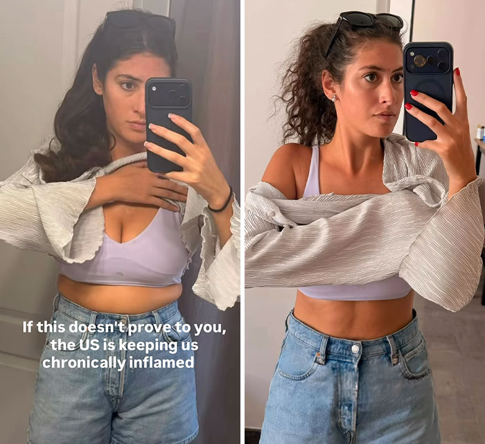 Expert Chimes In After Woman Claims Her Before-And-After Pics Of Trip To France “Prove” The US Diet Keeps People “Chronically Inflamed” Expert Chimes In After Woman Claims Her Before-And-After Pics Of Trip To France “Prove” The US Diet Keeps People “Chronically Inflamed”