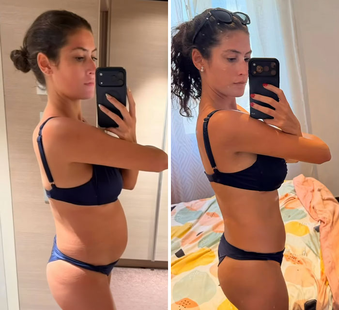 Expert Chimes In After Woman Claims Her Before-And-After Pics Of Trip To France “Prove” The US Diet Keeps People “Chronically Inflamed” Expert Chimes In After Woman Claims Her Before-And-After Pics Of Trip To France “Prove” The US Diet Keeps People “Chronically Inflamed”