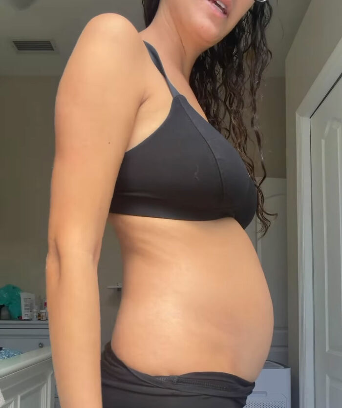 Expert Chimes In After Woman Claims Her Before-And-After Pics Of Trip To France “Prove” The US Diet Keeps People “Chronically Inflamed” Expert Chimes In After Woman Claims Her Before-And-After Pics Of Trip To France “Prove” The US Diet Keeps People “Chronically Inflamed”