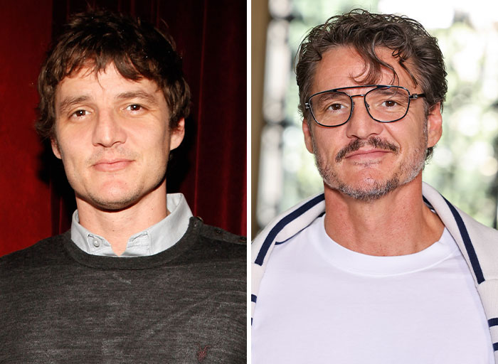 5 Before And After Fame Shots That Highlight How Much Celebrities’ Styles Transform