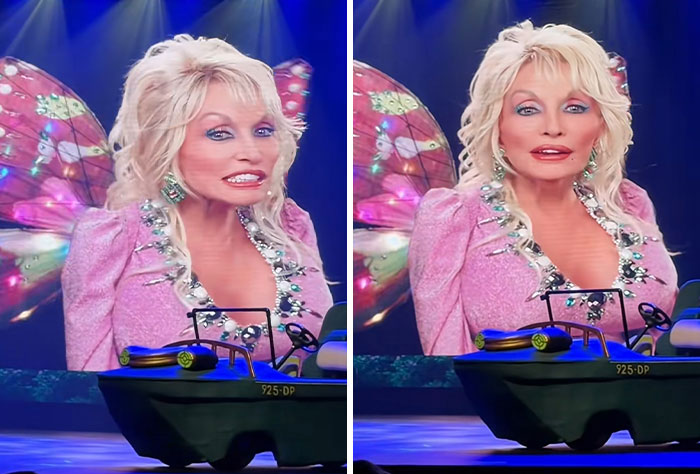 Dolly Parton’s Sister Reveals The Selfless Offer The Late Legend Made To Doctors During Her Devastating Cancer Battle Dolly Parton’s Sister Reveals The Selfless Offer The Late Legend Made To Doctors During Her Devastating Cancer Battle