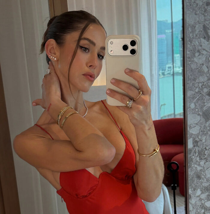 How Young Is Too Young To Get A Korean Facelift? Netizens Criticize Influencer’s Decision After Recovery Posts How Young Is Too Young To Get A Korean Facelift? Netizens Criticize Influencer’s Decision After Recovery Posts