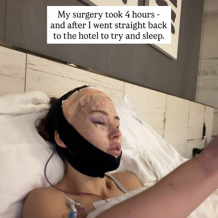 How Young Is Too Young To Get A Korean Facelift? Netizens Criticize Influencer’s Decision After Recovery Posts How Young Is Too Young To Get A Korean Facelift? Netizens Criticize Influencer’s Decision After Recovery Posts
