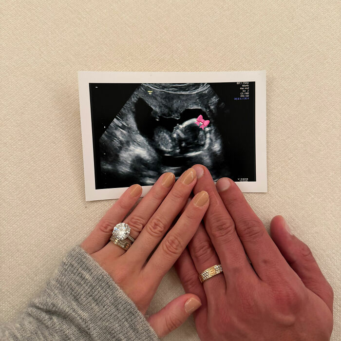 Pregnant Influencer Shows Off Luxurious Maternity Suite Provided By Billionaire Baby’s Dad, It Backfires