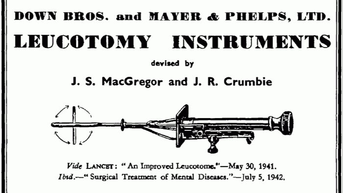 28 Terrifying Methods And Tools That Doctors Used In The Past To Treat Patients