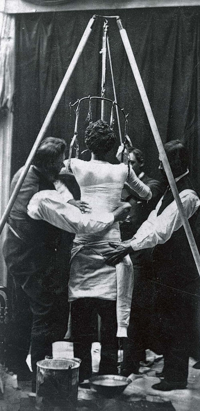 28 Terrifying Methods And Tools That Doctors Used In The Past To Treat Patients