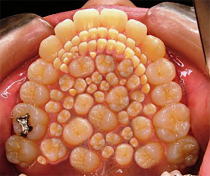 57 Unsettling Photos And Pictures That Made People Regret Having Eyes 57 Unsettling Photos And Pictures That Made People Regret Having Eyes