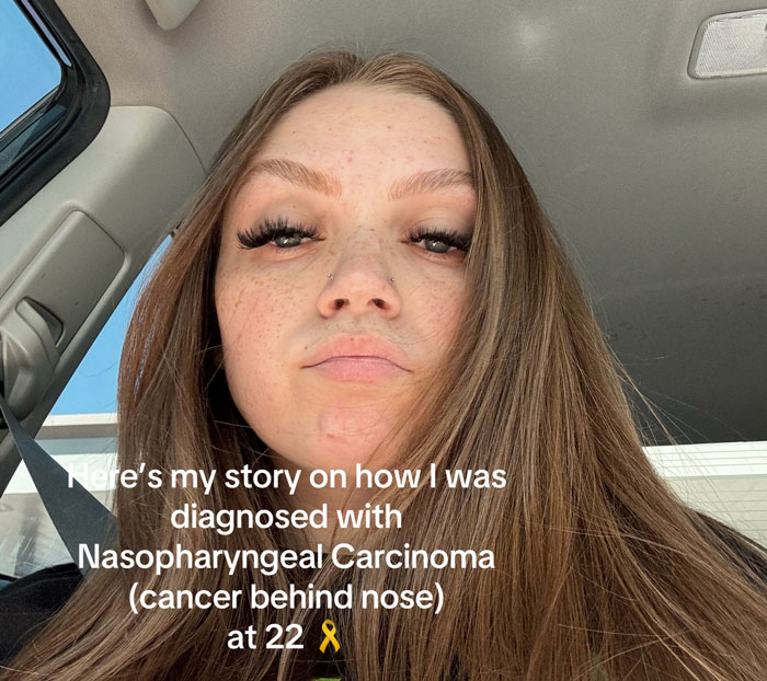 Woman&rsquo;s &ldquo;Altitude Sickness&rdquo; Turns Out To Be A Rare Cancer After Her Ears Won&rsquo;t Pop After Her Flight