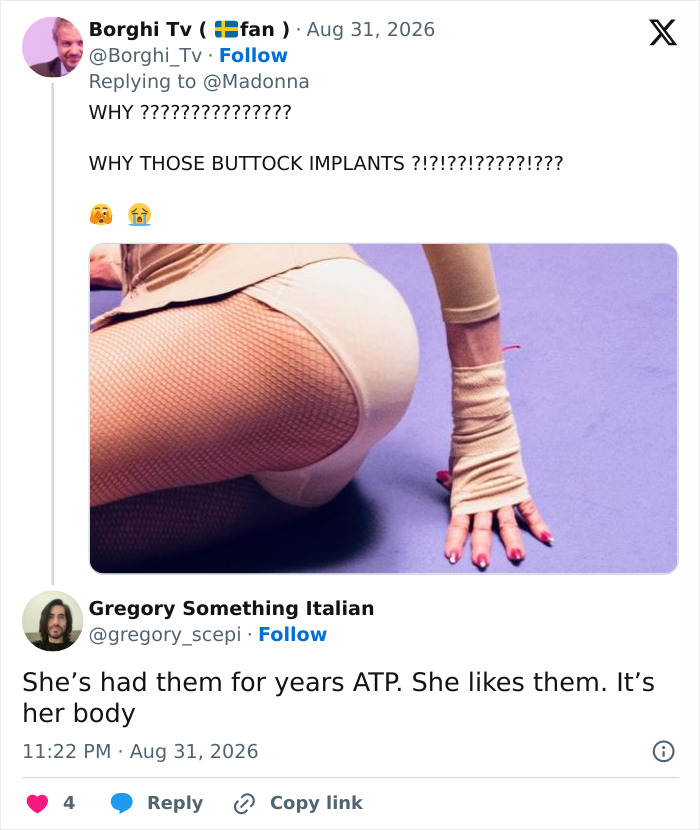 Madonna Slammed After Fans Noticed Odd Details In Latest Photos: “What’s Happening Here?”