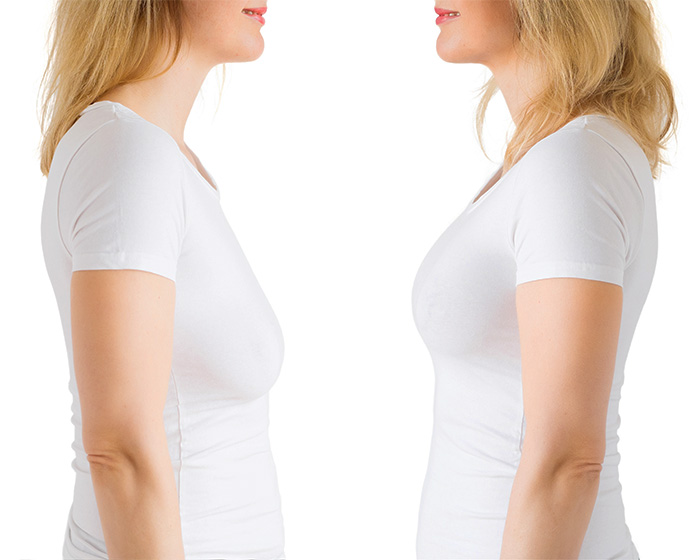 New Study Reveals The ‘Perfect’ Breast Shape, And It’s Not The Size Most Plastic Surgeons Push For New Study Reveals The ‘Perfect’ Breast Shape, And It’s Not The Size Most Plastic Surgeons Push For