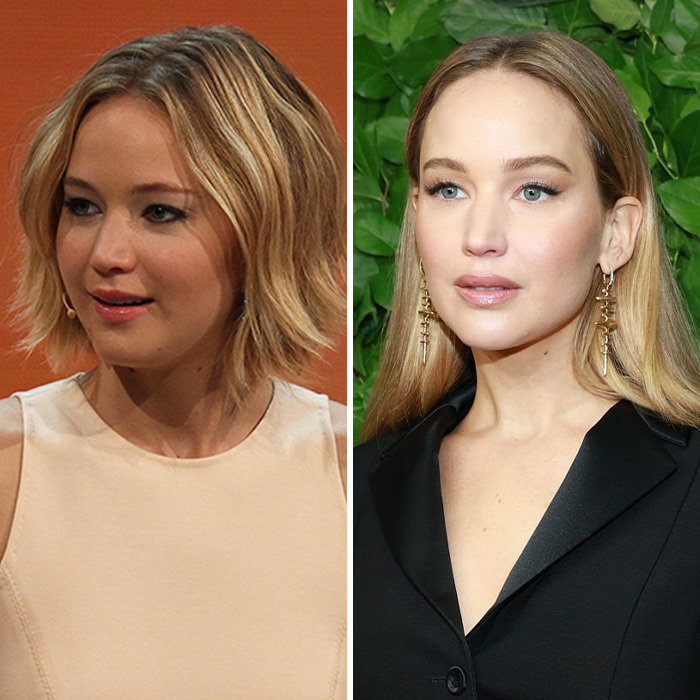 Jennifer Lawrence’s Plastic Surgery Confession Draws Backlash As Photoshoot Sparks Fresh Scrutiny Jennifer Lawrence’s Plastic Surgery Confession Draws Backlash As Photoshoot Sparks Fresh Scrutiny
