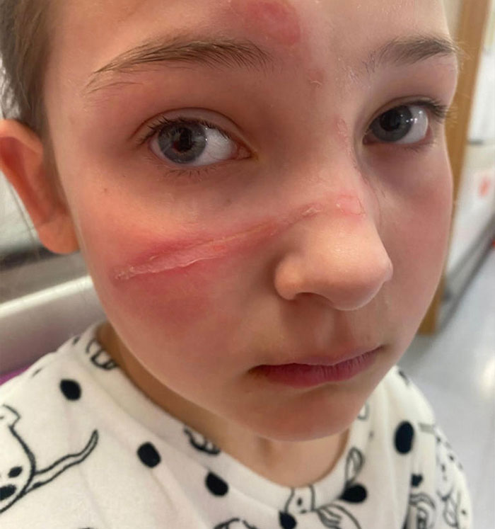 Popular Squishy Toys Pulled From Market After Children Are Hospitalized With Serious Injuries Popular Squishy Toys Pulled From Market After Children Are Hospitalized With Serious Injuries
