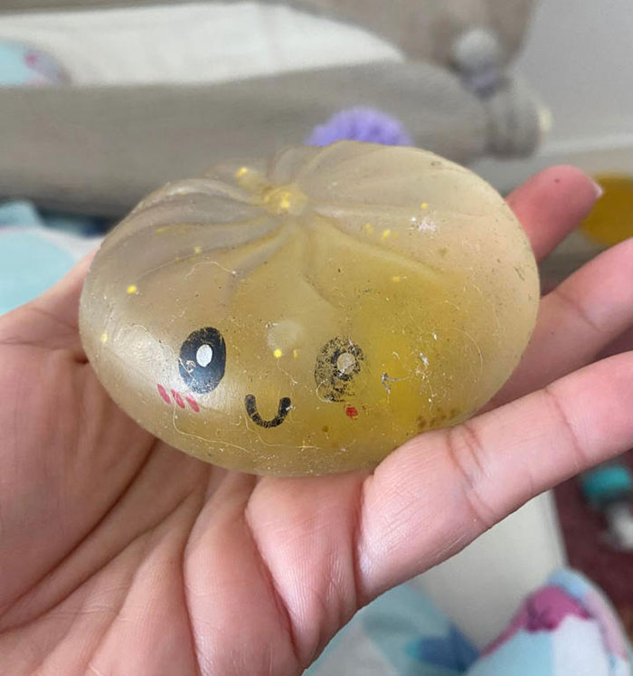 Popular Squishy Toys Pulled From Market After Children Are Hospitalized With Serious Injuries Popular Squishy Toys Pulled From Market After Children Are Hospitalized With Serious Injuries