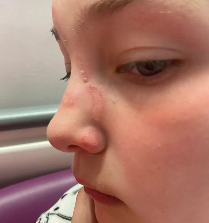 Popular Squishy Toys Pulled From Market After Children Are Hospitalized With Serious Injuries Popular Squishy Toys Pulled From Market After Children Are Hospitalized With Serious Injuries